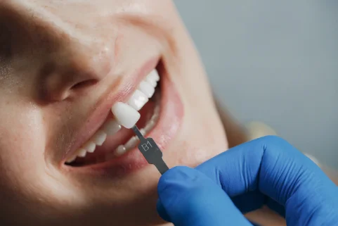 dental treatments