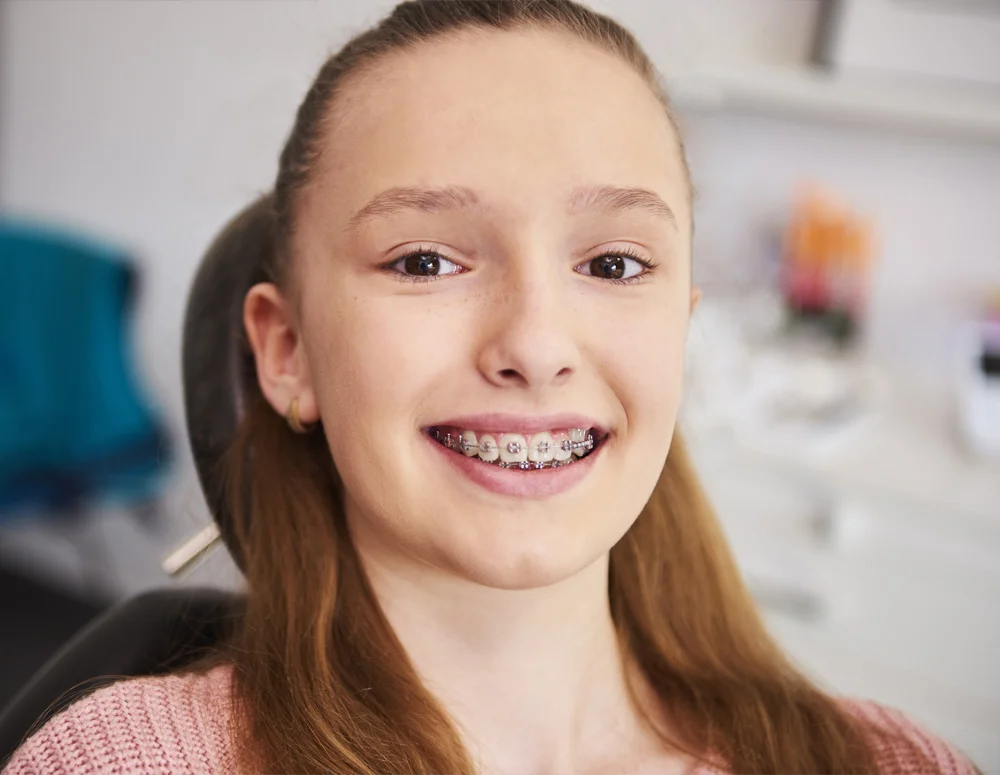 https://dinamik.yoursmileturkey.com/wp-content/uploads/2023/03/orthodontic-treatments-before-after.webp