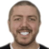 https://dinamik.yoursmileturkey.com/wp-content/uploads/2023/03/owen-mason-min.png