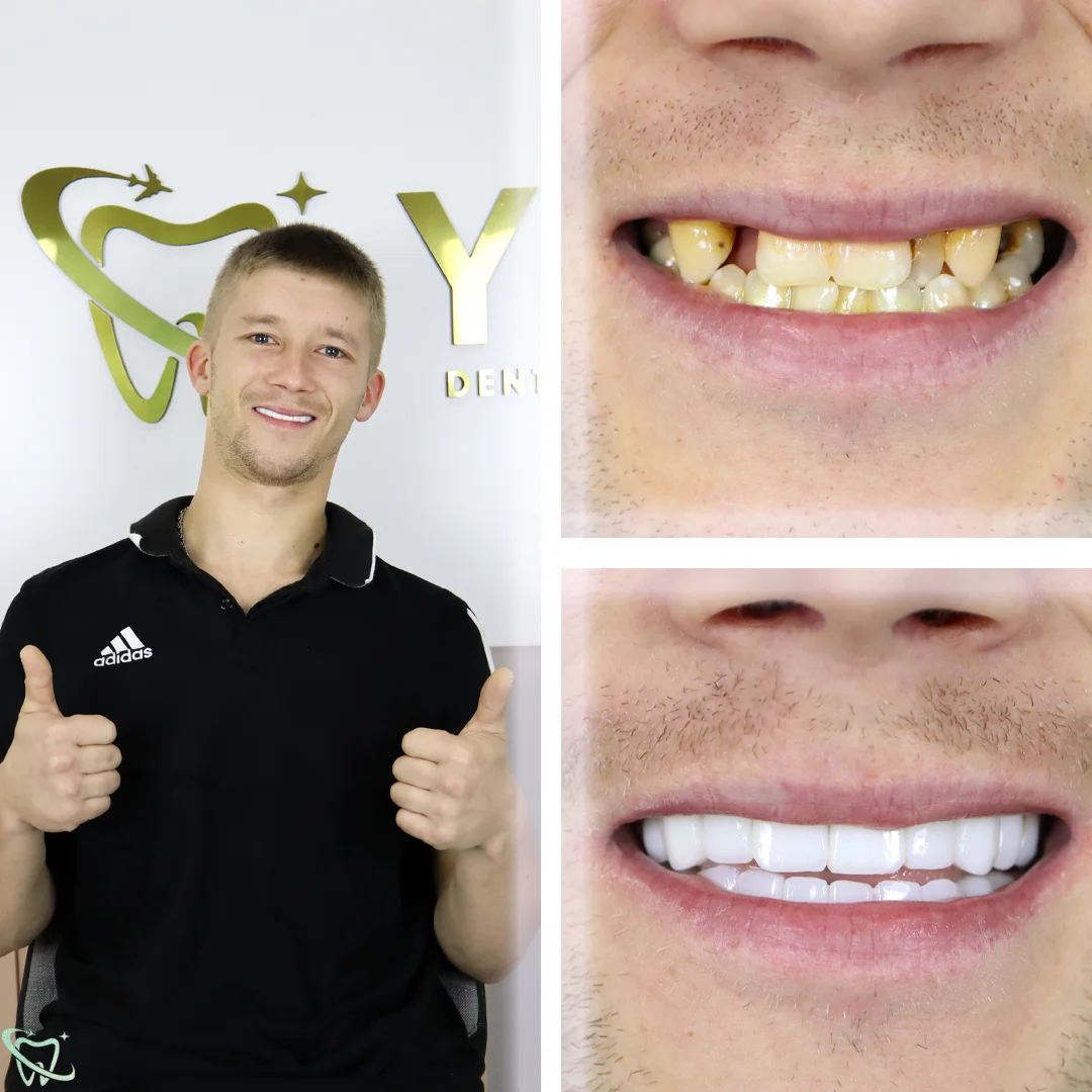 renatas before after (1)