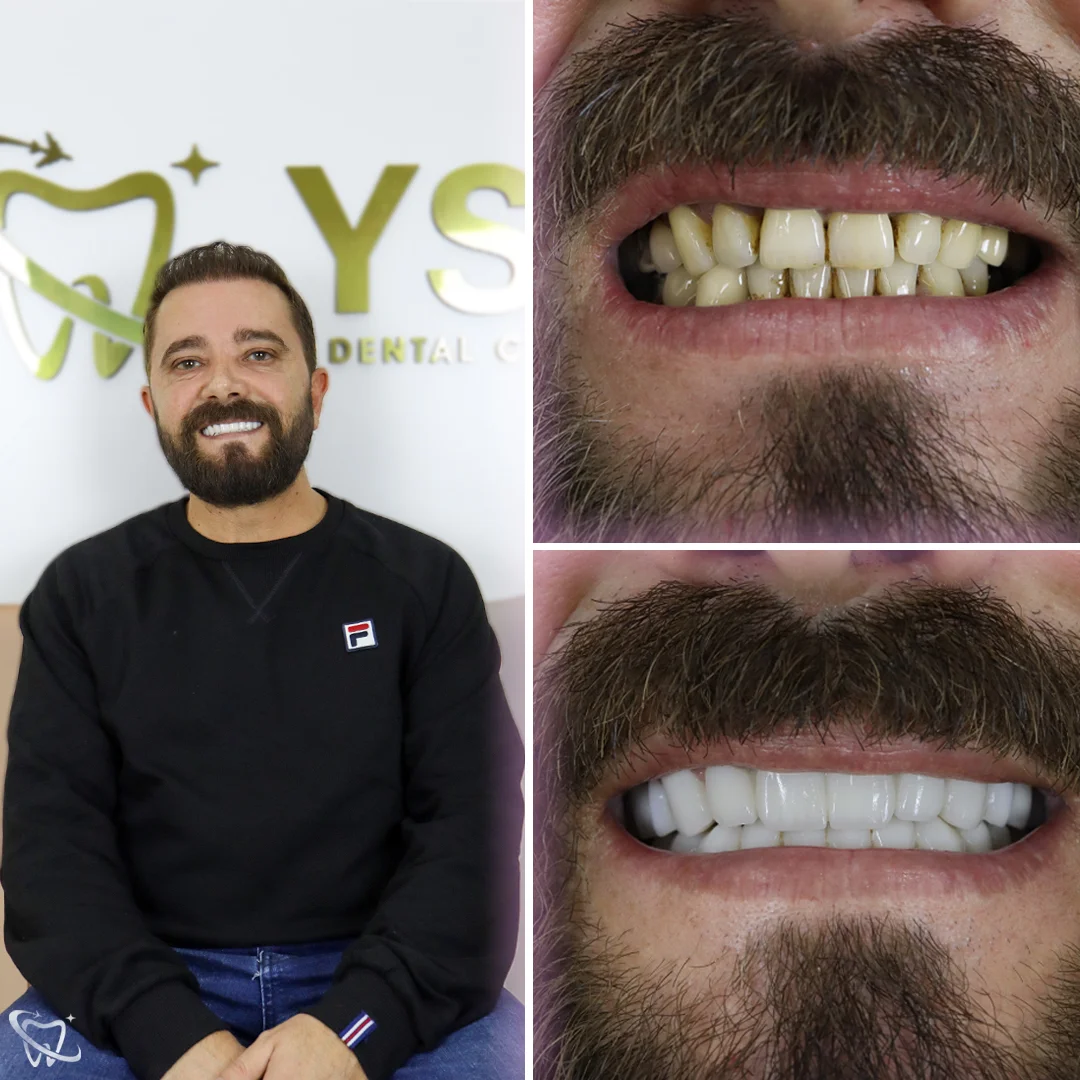 smile-beforeandafter