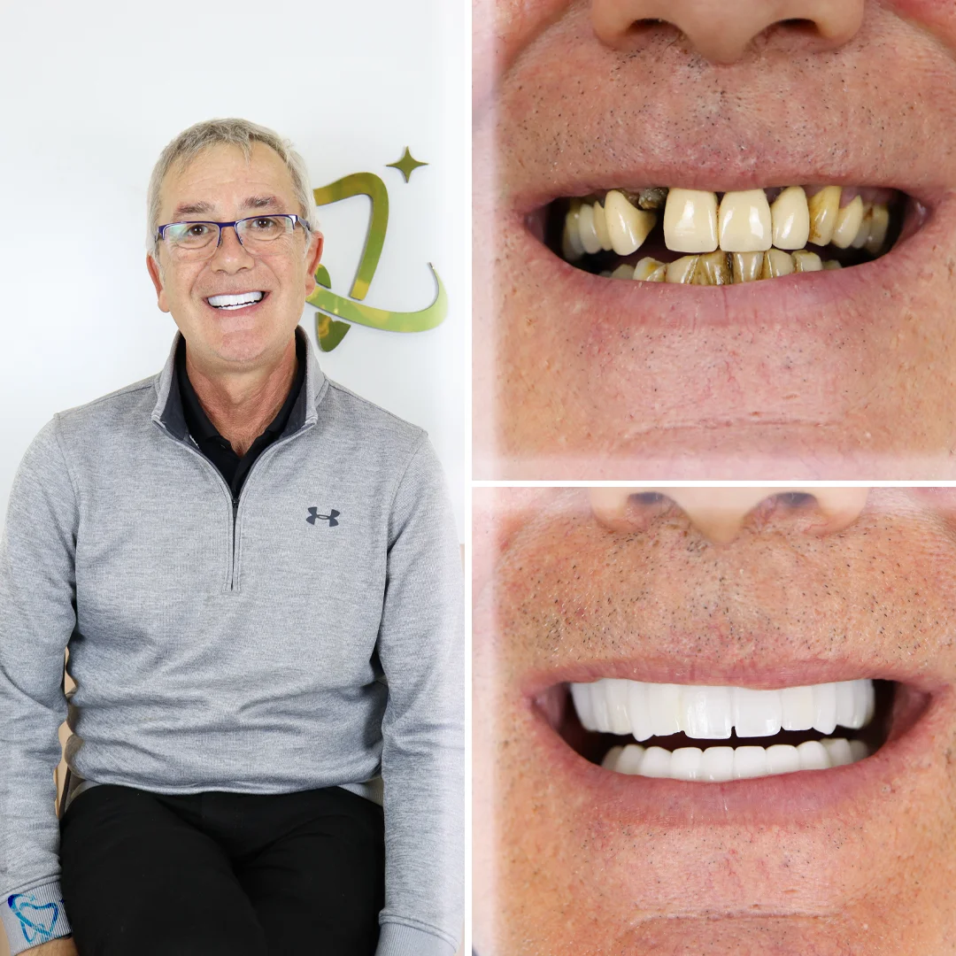 smile-design