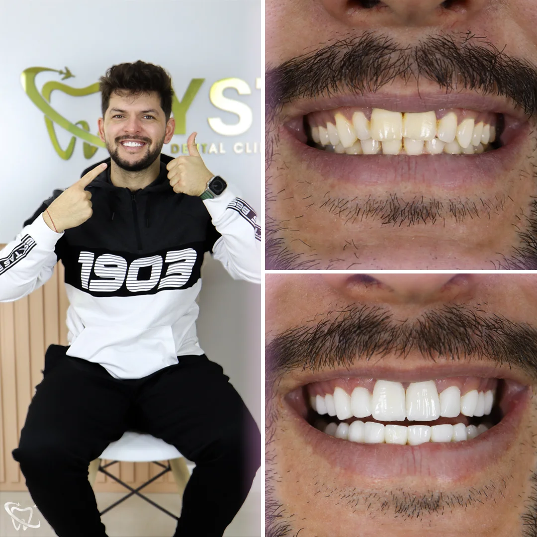 your-smile-turkey-dental-clinic